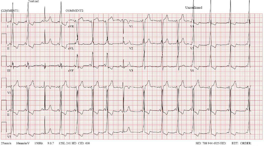 Home - Arrhythmia Alliance