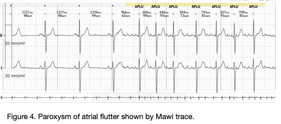 Home - Arrhythmia Alliance